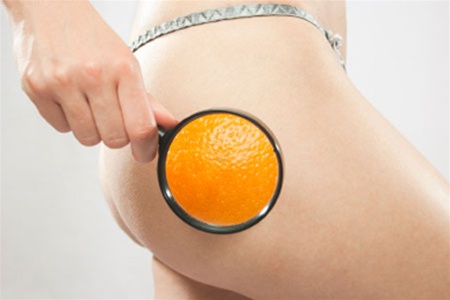 Антицелюлітна дієта: як позбутися «апельсинової кірки» раз і назавжди